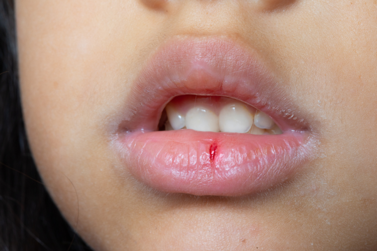 The Ultimate Guide to Natural Lip Products for Healthy, Beautiful Lips