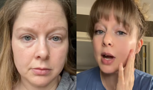 Tallow for Dry, Flaky Skin: Does It Actually Work?