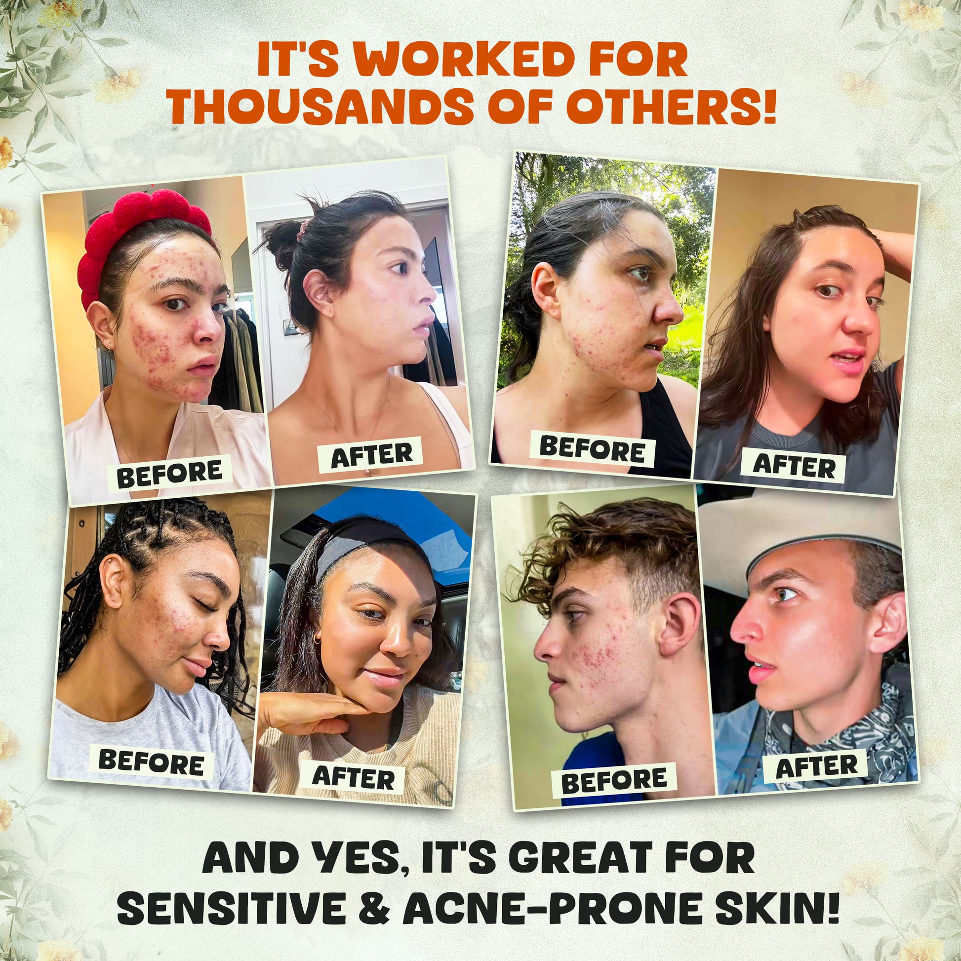 Bálsamo facial de miel de Manuka El mejor bálsamo de sebo de res del mundo